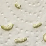Bauchspeicheldrüse Kot bei Erkrankung der Bauchspeicheldrüse