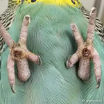 Sohlenballengeschwür Sohlenballengeschwür (KI)